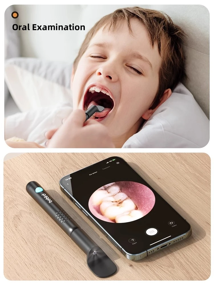 Bebird R3 Oorreiniger Smart Vi - Pet Ear Cleaner recensie en prijs